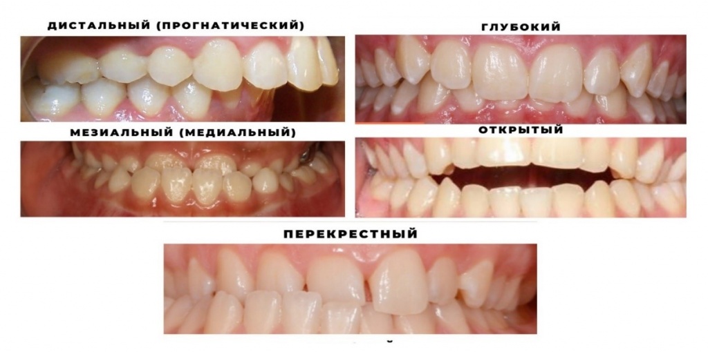 стоматология ортодонтическая3.jpg